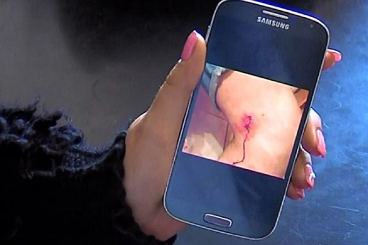 Nem látták el a vérző fiút