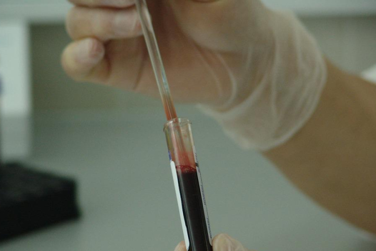 Újabb európai országban azonosítottak majomhimlős beteget