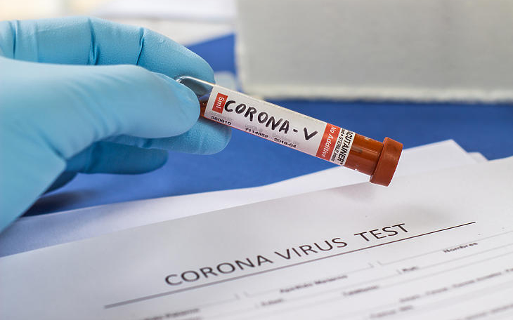 Csökkent a karanténok száma, ma sem regisztráltak új fertőzöttet