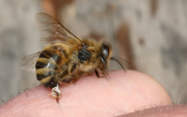 Méhcsípés miatt kellett újraéleszteni