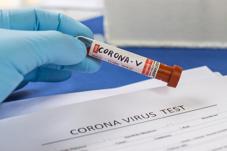 Csökkent a karanténok száma, ma sem regisztráltak új fertőzöttet