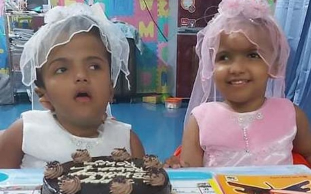 Jól vannak az egy évvel ezelőtt szétválasztott sziámi ikrek