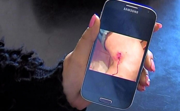 Nem látták el a vérző fiút